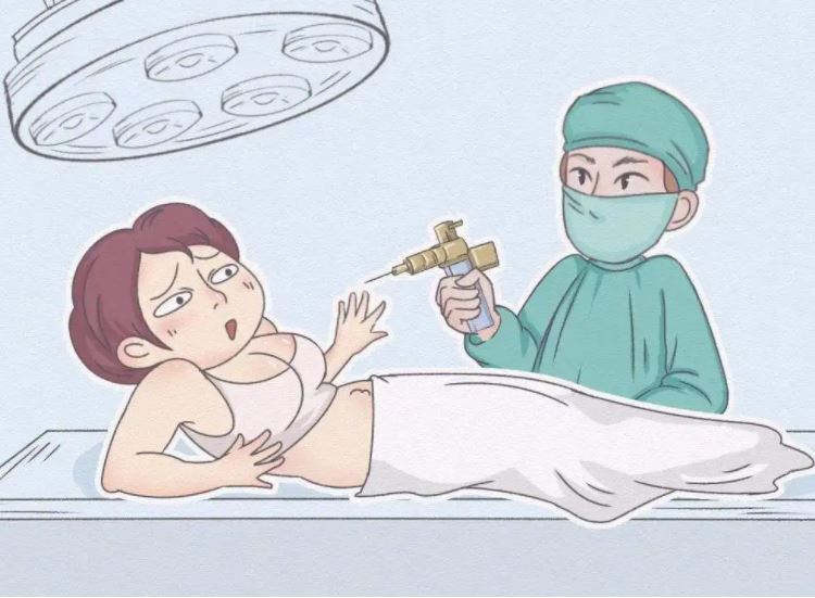 全身抽脂對身體有什么傷害？